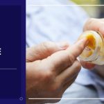 Arthritis rheumatoid remedies treatments curemyjointpain