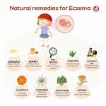 Eczema treatment natural remedies lybrate